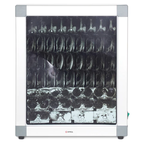 Негатоскоп общего назначения АРМЕД 1-кадровый, размер экрана 395х480 мм, 1726301 631203 - МСК «Форвард»